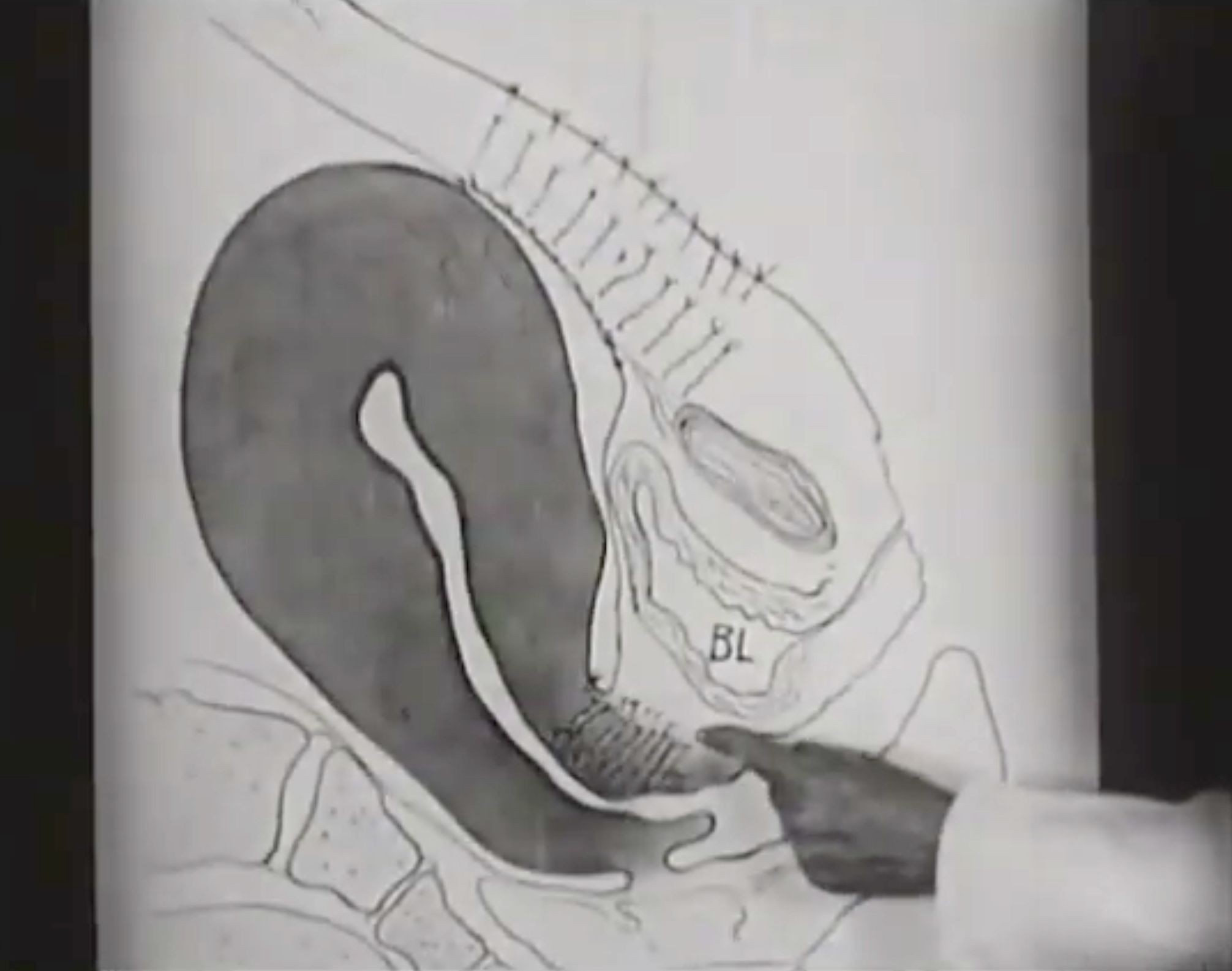 The Science and Art of Obstetrics (Die Wissenschaft und Kunst der Geburtshilfe), 1936, Medicine on Screen / Foto: National Library of Medicine