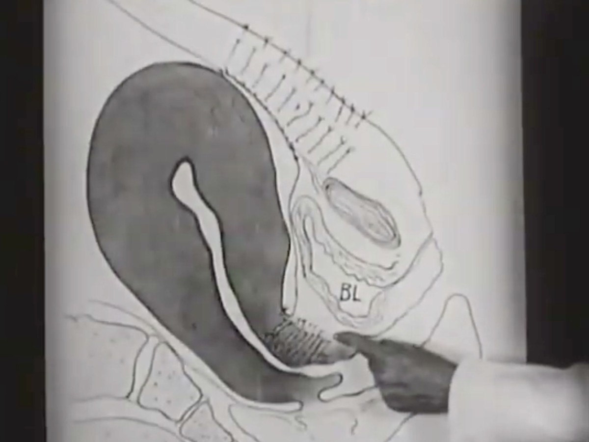 The Science and Art of Obstetrics (Die Wissenschaft und Kunst der Geburtshilfe), 1936, Medicine on Screen / Foto: National Library of Medicine