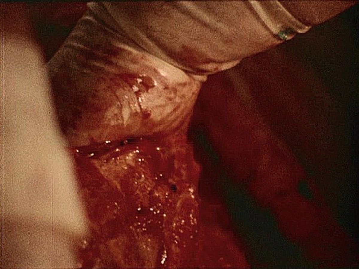 The Act of Seeing With One's Own Eyes, 1971, Stan Brakhage The Act of Seeing With One's Own Eyes, 1971, Stan Brakhage